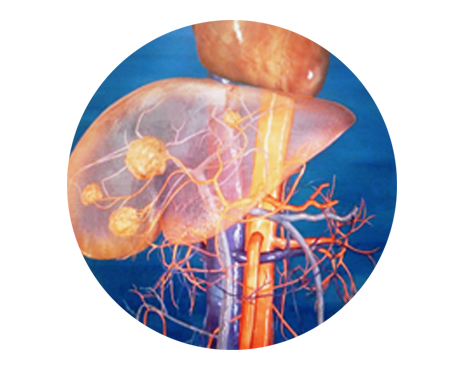 treatments_circles_yttrium treatments_circles_yttrium